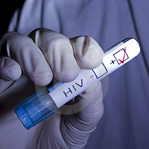 HIV-positive 