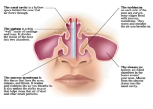 allergic rhinitis