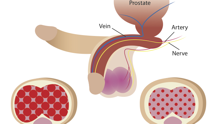 Erectile-dysfunction